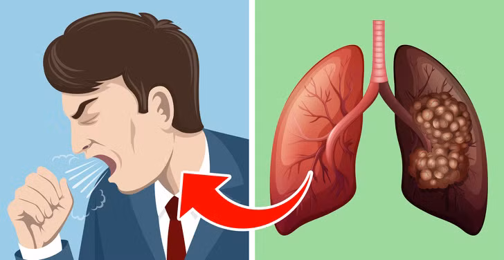 5 dau hieu bao dong phoi ban dang co van de-Hinh-2