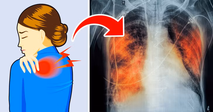 5 dau hieu bao dong phoi ban dang co van de