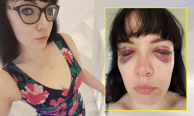 Nu doanh nhan “hoa” gau truc panda sau khi xam mi mat