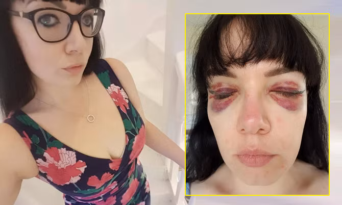 Nu doanh nhan “hoa” gau truc panda sau khi xam mi mat