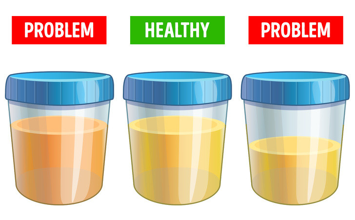 5 dau hieu canh bao soi than ai cung can ghi nho-Hinh-2