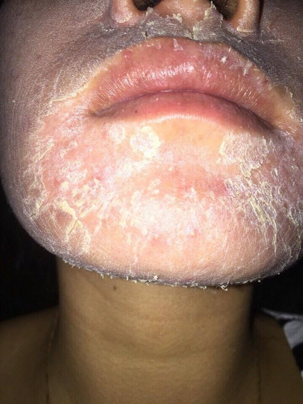 Hoang hon nhung guong mat bien dang vi dung nuoc lot da tay trang