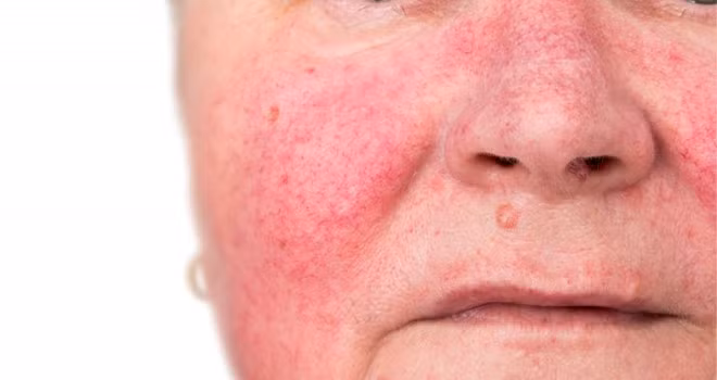 Hoang hon nhung guong mat bien dang vi dung nuoc lot da tay trang-Hinh-3