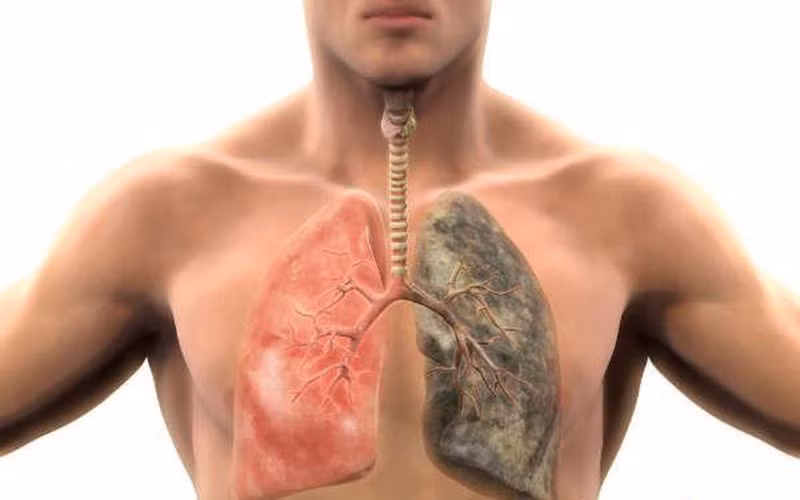 Tác dụng làm sạch phổi: Đây là món ăn được khuyến khích dành cho những người thích hút thuốc, vì mộc nhĩ đen có vai trò làm sạch phổi, ăn nhiều sẽ có tác dụng vệ sinh phổi, nhuận phổi một cách tối ưu.