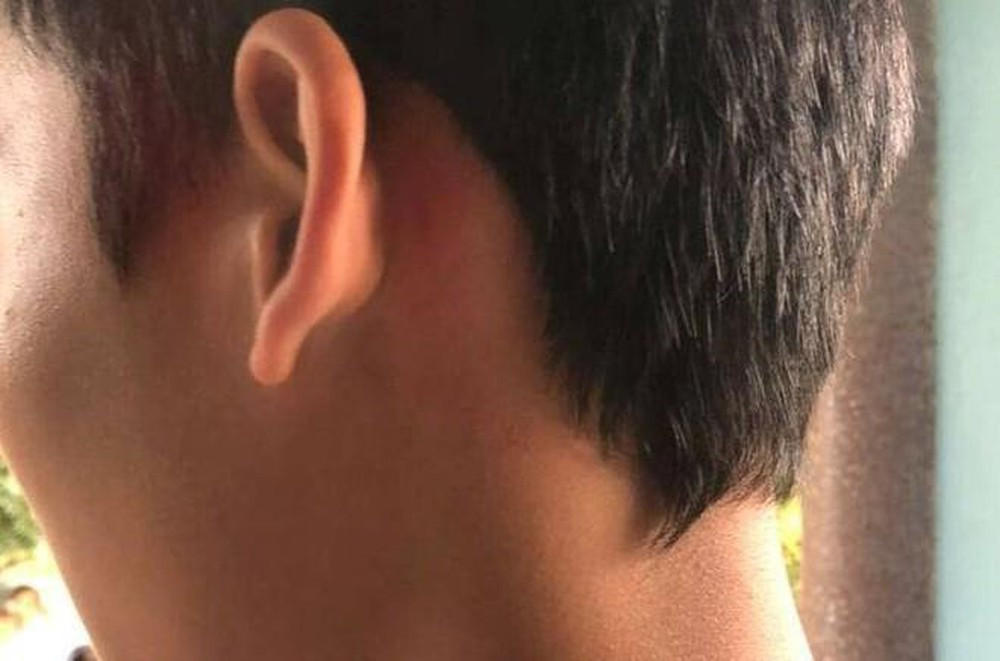 Con bi ban danh, bo keo hoi den truong tra dua hoc sinh lop 8