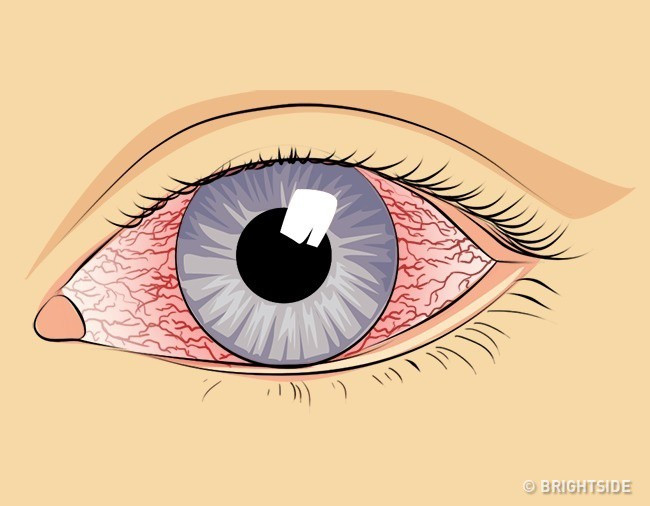 9 cach tu nhien de lam sach phoi cuc don gian ma hieu qua-Hinh-3