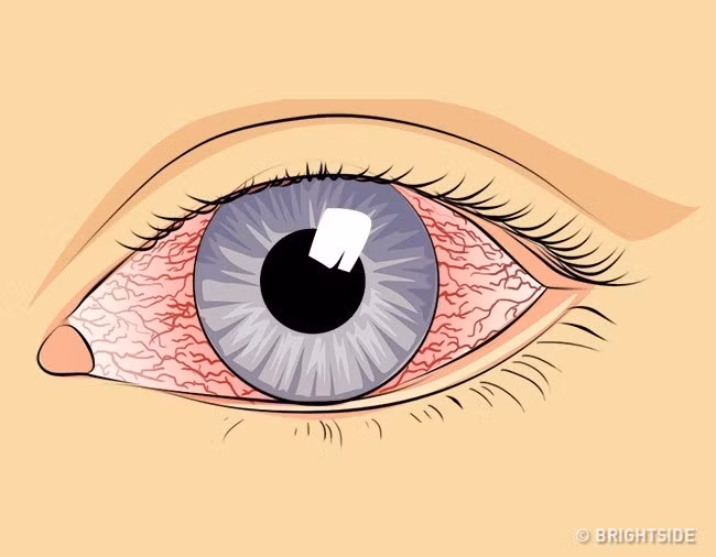 9 cach tu nhien de lam sach phoi cuc don gian ma hieu qua-Hinh-3