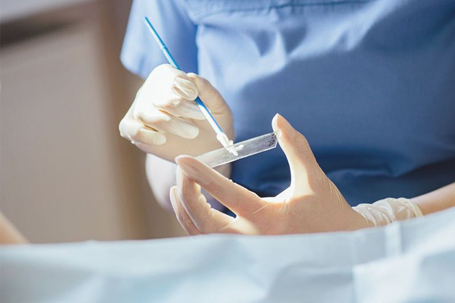 Chị em đi khám ung thư tử cung ngay nếu sau 25 tuổi có dấu hiệu này - Hình 3 Chi em di kham ung thu tu cung ngay neu sau 25 tuoi co dau hieu nay-Hinh-3