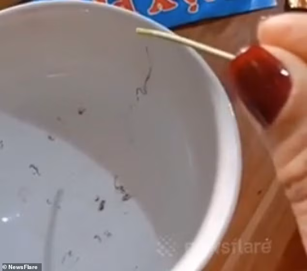 Kinh di canh gap hang chuc con giun trong mat nguoi phu nu Cao Bang len bao Tay-Hinh-2