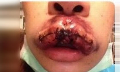 Nếu sử dụng mực xăm đểu có nguồn gốc Trung Quốc, mực xăm rẻ tiền chứa hóa chất độc hại được các cơ sở thẩm mỹ quy mô nhỏ sử dụng vì tham lợi nhuận, người dùng sẽ gặp phải những nguy cơ bị xăm môi hỏng và có thể ảnh hưởng đến hình dáng môi nếu tình trạng nhiễm trùng nặng do không giữ vệ sinh và được điều trị kịp thời. 