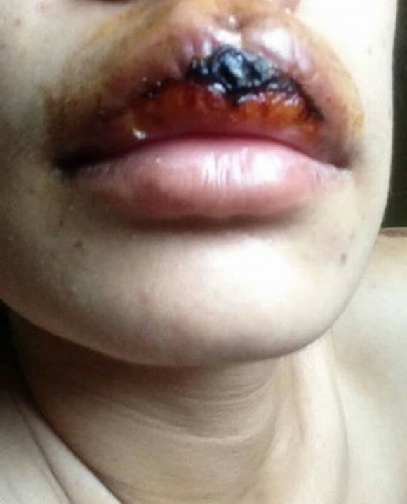 Sử dụng các loại mực xăm chất lượng từ châu Âu, hoặc các sản phẩm chiết xuất thảo mộc tự nhiên sẽ ít khả năng dị ứng hơn.