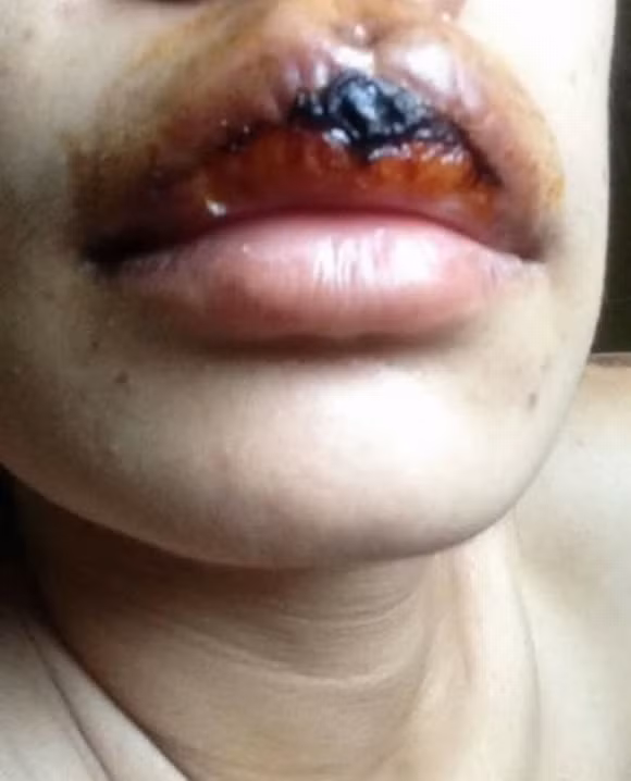 Sử dụng các loại mực xăm chất lượng từ châu Âu, hoặc các sản phẩm chiết xuất thảo mộc tự nhiên sẽ ít khả năng dị ứng hơn.