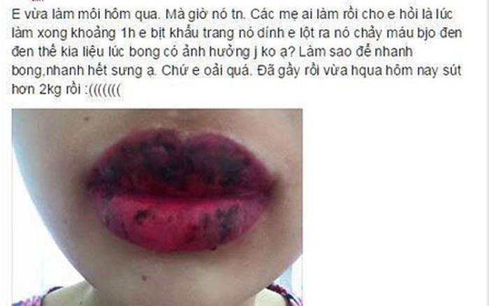 Rất nhiều trường hợp xăm môi hỏng khiến môi không đều màu, viền môi bị lệch, màu xăm biến đổi không được như màu mực gốc đã chọn.