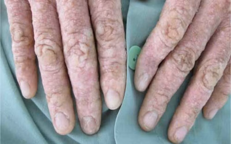 Tiếp xúc với các hóa chất trong thuốc trừ sâu và kim loại nặng bị nhiễm qua hoa quả, rau xanh... cũng gây tổn thương gan.