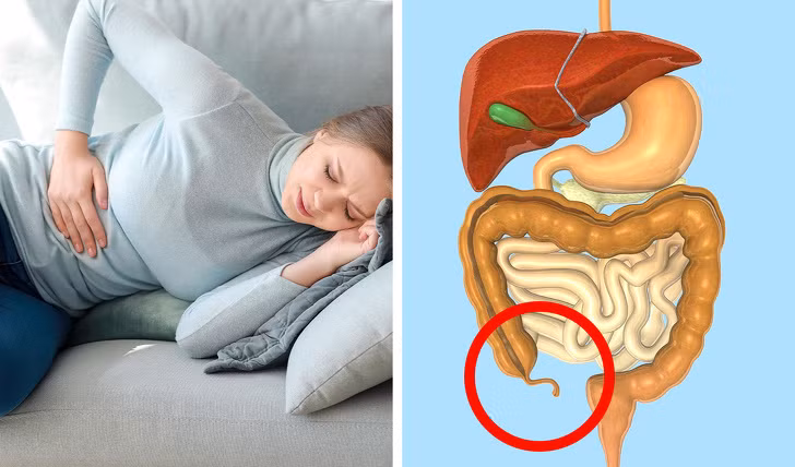 Ruột thừa: Đây là một túi nhỏ nằm gần ruột già. Ruột thừa thường được coi là một bộ phận vô dụng trên cơ thể, tuy nhiên, nó lại có tác dụng bảo vệ vi khuẩn tốt trong ruột. Khi bạn bị tiêu chảy, vi khuẩn tốt trong ruột thừa sẽ giúp bạn chống chọi lại với triệu chứng này. 