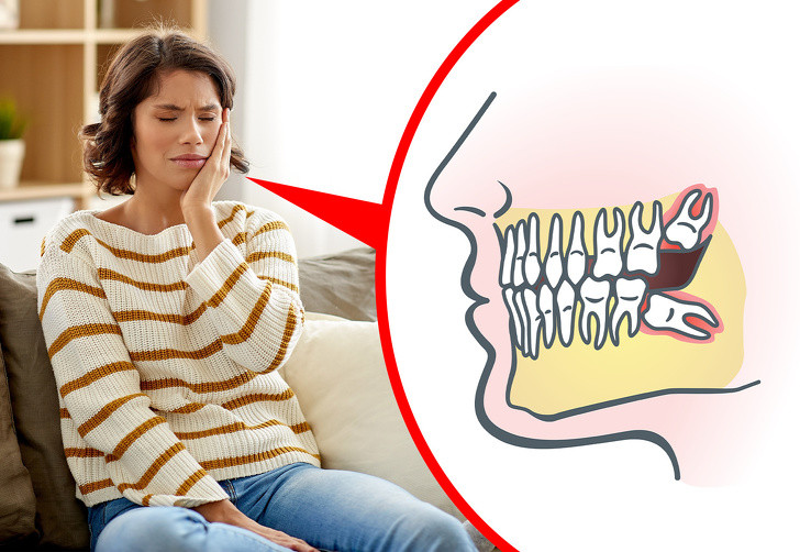 Răng khôn: Thời xưa, răng khôn vốn sinh ra để con người có thể nhai các loại thực phẩm cứng như rễ, lá, thịt và các loại hạt. Sau này, khi con người ăn thực phẩm chín, răng khôn không còn tác dụng nhai mà trở thành răng dự phòng.