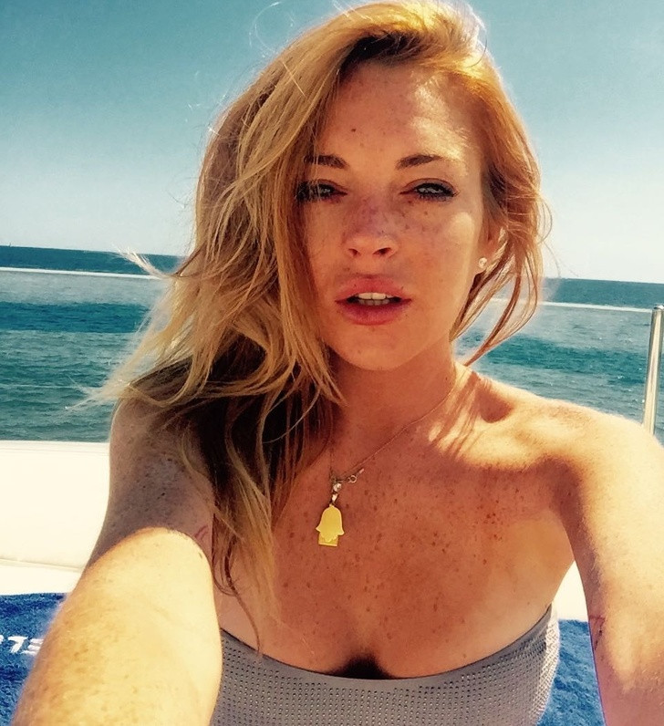 Tàn nhang có thể khiến nhiều bạn gái buồn phiền bởi nó làm làn da kém tươi sáng. Tuy nhiên, tàn nhang thực sự có ích cho làn da bởi nó có tác dụng như một loại kem chống nắng tự nhiên, giúp chống lại tác hại của tia UV lên da. Ảnh: BS.