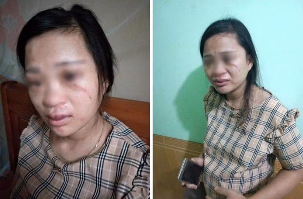 Chong lay cap phoi cua vo cho bo: Nhuc nha ruoc loat chong “can ba”...-Hinh-3