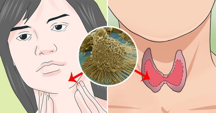 Dau hieu tang can bat thuong “bao dong” van de suc khoe-Hinh-3