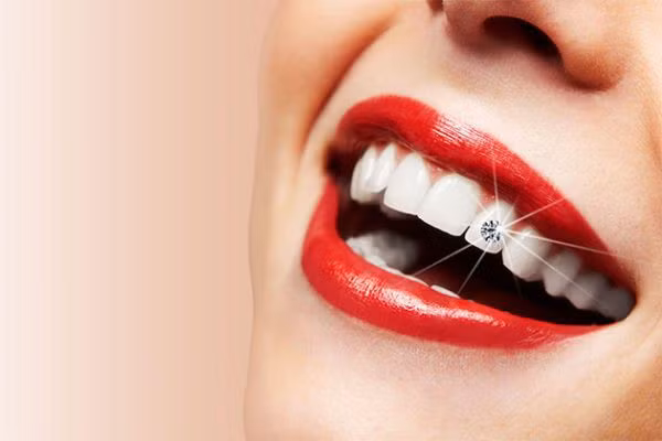 Điểm danh những thực phẩm cho răng trắng bóng, chắc khỏe Diem danh nhung thuc pham cho rang trang bong, chac khoe