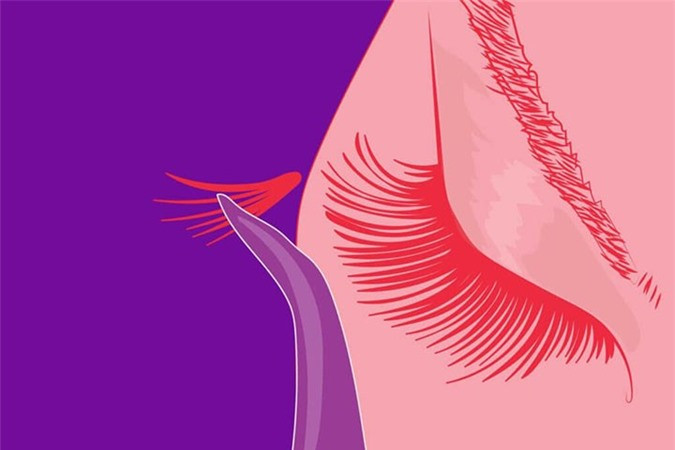 Sử dụng lông mi giả: Việc lạm dụng lông mi giả sẽ dẫn đến những hậu quả ngoài mong muốn, lớp keo dính khá chắc chắn ấy sẽ làm ảnh hưởng đến những sợi lông mi thật, do đó khi gỡ lông mi giả ra thì nó cũng kéo theo một lượng lông mi thật. Do đó, bạn không nên gắn mi giả quá thường xuyên và luôn luôn đi đến một salon có uy tín.