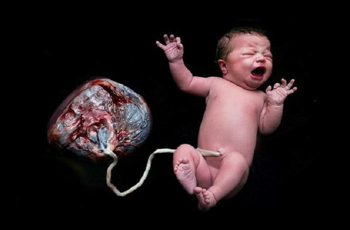 San phu TP HCM tu sinh tai nha, con tu vong: Cai chet bao truoc, sao nguoi me lam the?