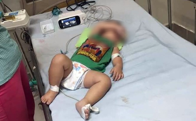 Chỉ trong năm nay, căn bệnh chết người Whitmore đã cướp đi mạng sống của hàng chục người trên nhiều tỉnh thành Việt Nam. Gần đây, sự việc một gia đình ở Sóc Sơn (Hà Nội) có 3 con nhỏ lần lượt tử vong với các triệu chứng bệnh Whitmore khiến dư luận hết sức hoang mang.