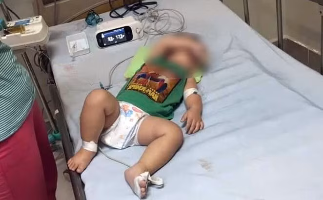 Chỉ trong năm nay, căn bệnh chết người Whitmore đã cướp đi mạng sống của hàng chục người trên nhiều tỉnh thành Việt Nam. Gần đây, sự việc một gia đình ở Sóc Sơn (Hà Nội) có 3 con nhỏ lần lượt tử vong với các triệu chứng bệnh Whitmore khiến dư luận hết sức hoang mang.