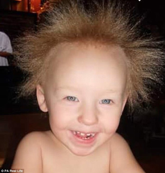 Hàng ngày, mẹ của cô bé phải dùng loại dầu gội cao cấp để gội đầu cho Charleigh nhằm cung cấp nhiều dưỡng chất hơn cho mái tóc của con gái.