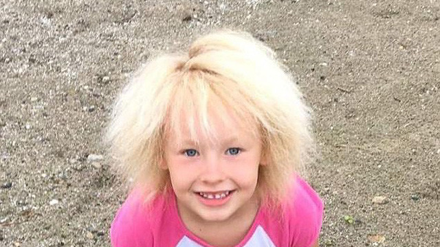 Việc chải tóc khiến Phoebe bị đau và khó chịu, mẹ của Phoebe thường xịt đủ mọi thứ lên tóc con để chúng xẹp xuống nhưng chỉ 30 phút sau là nó lại dựng lên như cũ.