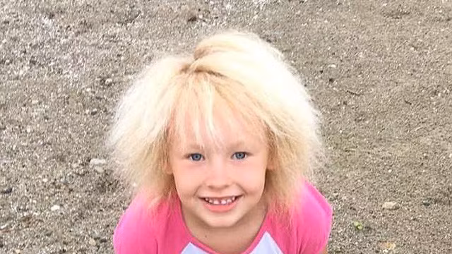 Việc chải tóc khiến Phoebe bị đau và khó chịu, mẹ của Phoebe thường xịt đủ mọi thứ lên tóc con để chúng xẹp xuống nhưng chỉ 30 phút sau là nó lại dựng lên như cũ.