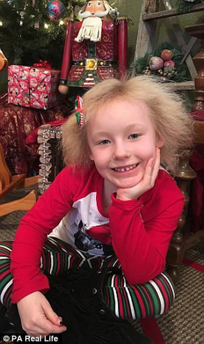 Chị Jamie – mẹ cô bé cho hay: "Tôi đã thử hàng chục sản phẩm nhằm mục đích kiểm soát mái tóc của Phoebe, nhưng chẳng có sản phẩm nào có tác dụng cả. Mỗi sáng, bé thức dậy, tóc đều dựng đứng hết cả lên".