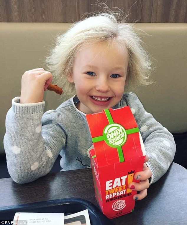 Trên thực tế, nhà khoa học thiên tài Albert Einstein cũng mắc phải hội chứng kỳ quặc này và có thể có đến hàng nghìn người trên thế giới mắc phải nhưng đến nay mới chỉ có hơn 100 trường hợp được biết đến.