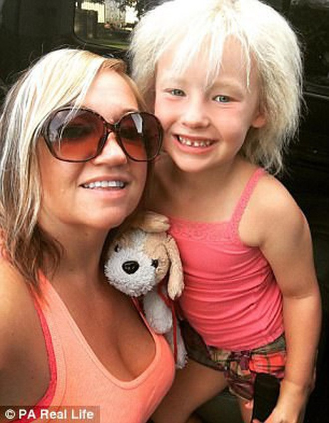 Theo chẩn đoán từ phía các bác sĩ, Charleigh đã mắc phải hội chứng Uncombable Hair - hội chứng tóc mất kiểm soát.