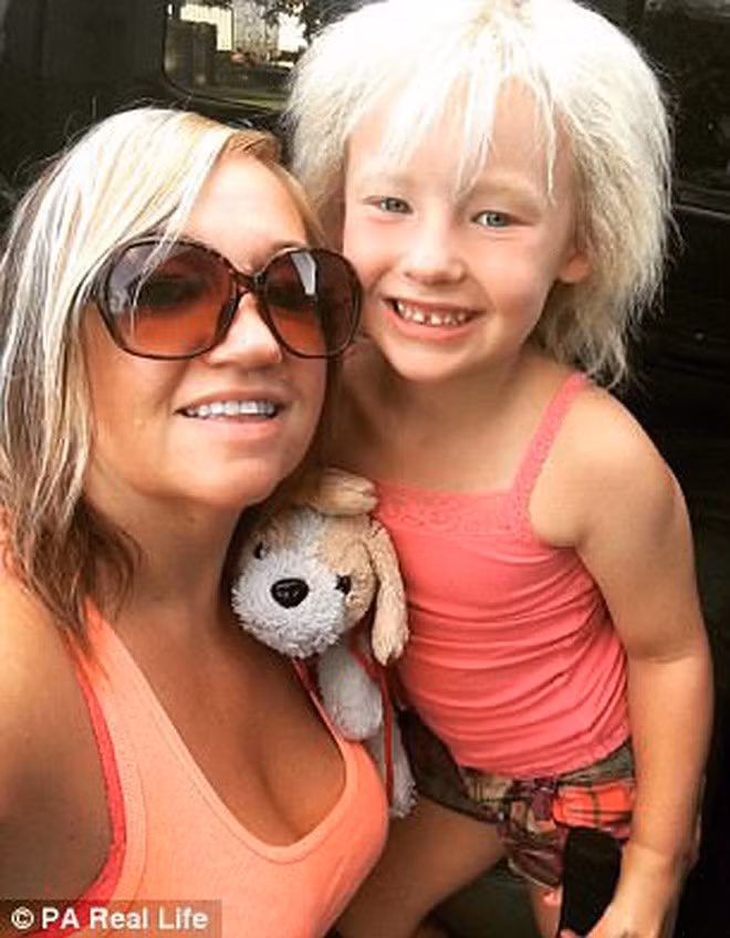 Theo chẩn đoán từ phía các bác sĩ, Charleigh đã mắc phải hội chứng Uncombable Hair - hội chứng tóc mất kiểm soát.