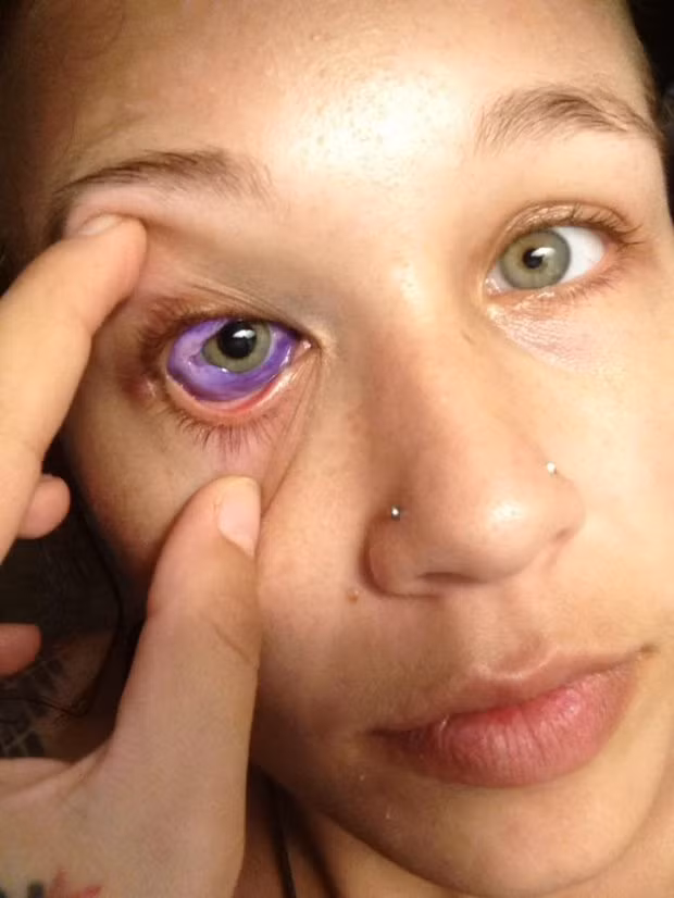 Trao luu xam nhan cau khien co gai suyt mu nguy hiem ra sao?-Hinh-2