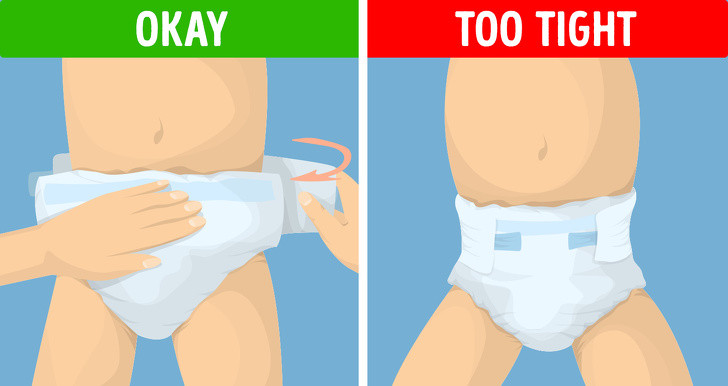 Mặc bỉm quá chật: Mua sắm bỉm dự trữ sẵn vào mỗi dịp giảm giá là một thói quen nuôi con tiết kiệm của cha mẹ. Tuy nhiên, các bé thường lớn rất nhanh, khoảng 140 – 200 gram/tuần, nên nếu cha mẹ mua quá nhiều bỉm dự phòng thì có khả năng số bỉm đó sẽ chật khi con đã lớn hơn 1 size. Vì vậy, khi mua sắm cho con, cha mẹ nên tính toán trừ hao.