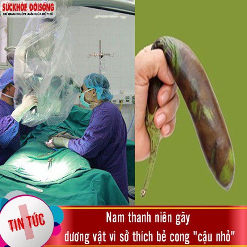 Bi hai nhung truong hop nam gioi “gay sung” vi ly do tro treu-Hinh-2