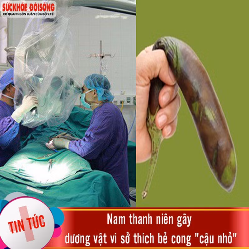 Bi hai nhung truong hop nam gioi “gay sung” vi ly do tro treu-Hinh-2