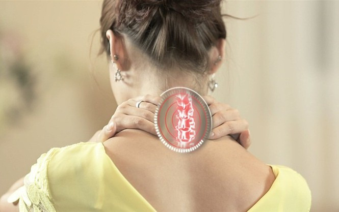 Thoai hoa cot song co: Can benh 'sat thu' voi dan van phong-Hinh-2