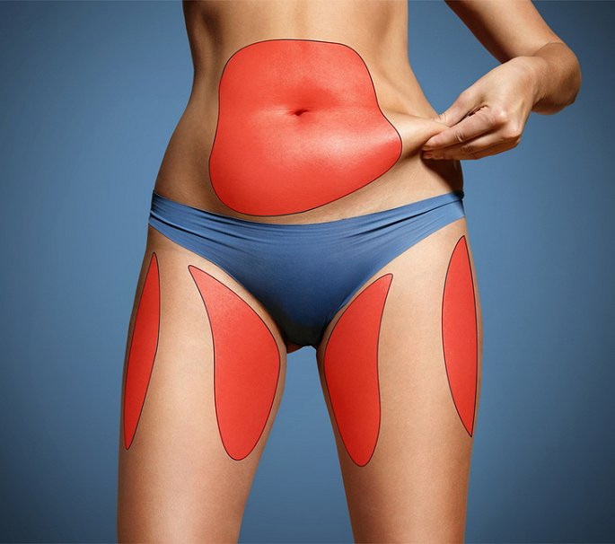 Tăng cân không lý do: Tăng cân không lý do có thể xuất phát từ nhiều nguyên nhân khác nhau, nhưng thiếu vitamin C cũng khiến cơ thể lâm vào tình trạng này. Một số nghiên cứu cho thấy, khi lượng vitamin C thấp đồng nghĩa với việc mỡ trong cơ thể sẽ tăng cao, đặc biệt là mỡ bụng. Bởi vitamin C giúp hỗ trợ đốt cháy chất béo hiệu quả.