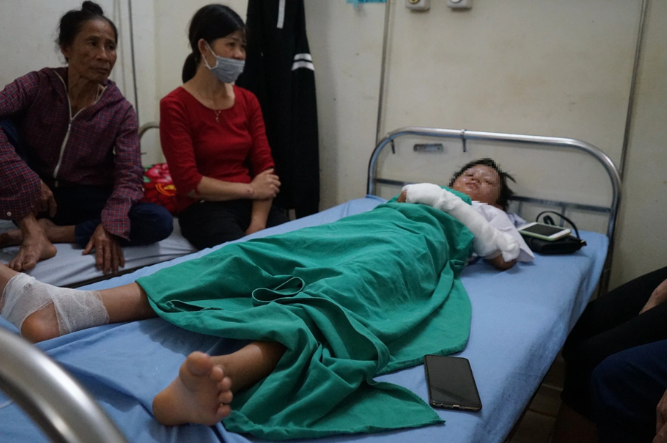 No bong bay lam 10 hoc sinh bi bong: Thay giao bi xu the nao?