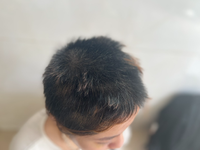  Thiếu nữ 16 tuổi bị chủ spa hành hạ vì ghen tuông: Ngày 30/6, Công an TP Thuận An, tỉnh Bình Dương đang lập hồ sơ, xử lý Đào Thị Huệ (26 tuổi, quê Phú Thọ, chủ spa ở Bình Dương) về hành vi cố ý gây thương tích và làm nhục người khác. Theo điều tra, Đào Thị Huệ có chồng là Lê Văn Đ (30 tuổi, ngụ P.An Phú, TP.Thuận An). Anh Đ cũng là chủ quán karaoke và quán ăn tại phường Bình Hoà, TP Thuận An. Nghi ngờ thiếu nữ 16 tuổi có quan hệ với chồng mình, Huệ đã 2 lần kêu cô này tới quán để đánh ghen, cắt tóc rồi quay clip đăng lên mạng xã hội.