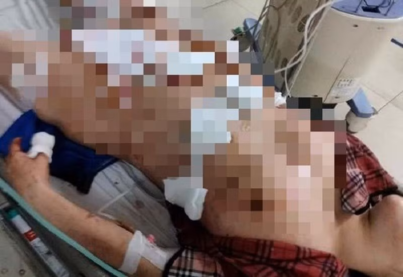 Hanh ha vo da man va loat vu bao hanh vi ghen gay chan dong