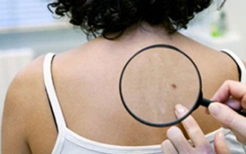 Dùng gậy “tự sướng” chụp lại vùng da khó thấy như mông, lưng và bả vai.