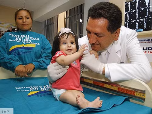 Hội chứng nàng tiên cá. Không đẹp như chuyện cổ tích, những người mắc hội chứng nàng tiên cá có đặc điểm hai chân dính liền vào nhau tạo thành hình giống như đuôi cá. Hầu hết những trường hợp mắc hội chứng này đều qua đời do những biến chứng ở bàng quang, thận.