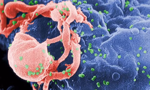 Gạ quan hẹ tình dục dẻ truyèn HIV cho nguòi dòng tính