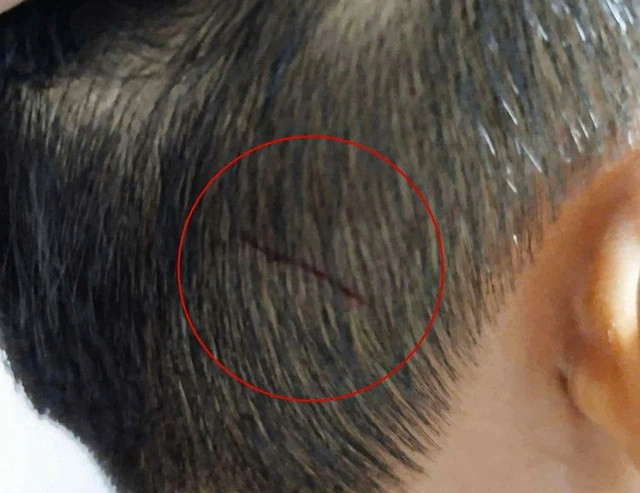 Giám đốc doanh nghiệp hành hung bé trai có thể đối diện hình phạt nào? - Hình 3 Giam doc doanh nghiep hanh hung be trai co the doi dien hinh phat nao?-Hinh-3