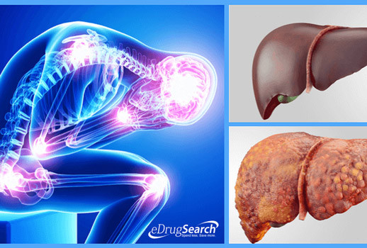 Đổ mồ hôi trộm vào ban đêm Thời tiết mát mẻ hoặc ngủ trong phòng điều hòa, một số người vẫn có triệu chứng đổ mồ hôi, đặc biệt ở lòng bàn tay và lòng bàn chân. Điều này theo y học phương Đông cho thấy bạn bị chứng can âm hư, dẫn đến mồ hôi không được kiềm chế. Lúc này cần uống thuốc để điều hòa gan. Theo Đông y, bạn nên ăn nhiều củ từ (khoai từ), thịt gà hầm để giúp tẩm bổ cho gan.