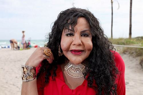 Sau ca phẫu thuật chui, Rajee cho biết lúc đầu cô cảm thấy rất hạnh phúc vì đã trở thành một phụ nữ thực sự với những đường cong gợi cảm. Tuy nhiên, niềm vui của cô chưa kéo dài được bao lâu thì cơn ác mộng đã ập đến. Khuôn mặt của Rajee bắt đầu biến dạng và đông cứng lại như đá, nhiều nơi xuất hiện những u nhọt lớn. Chúng bắt đầu phát triển ngày một to và chứa cả mủ xanh, mủ vàng trong đó. Cô được xem là một trong những thảm họa chuyển giới do nghiện dao kéo.